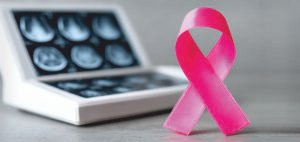 Read more about the article Samsung Teams Up with GRAIL to Launch Multi-Cancer Early Detection Test in Asia