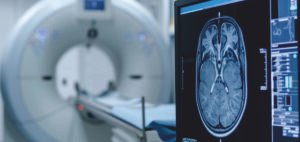 Read more about the article Indonesia Expands Diagnostic Imaging Nationwide Under SIHREN Programme with GE HealthCare Partnership
